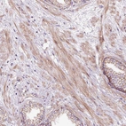 Immunohistochemical staining of human prostate shows moderate cytoplasmic positivity in smooth muscle cells.