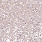 Anti-TPM3 Antibody