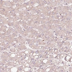 Immunohistochemical staining of human liver shows very weak cytoplasmic positivity in hepatocytes.