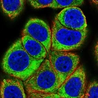 Immunofluorescent staining of human cell line MCF7 shows localization to cytosol.