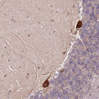 Anti-RPS3A Antibody