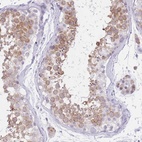 Anti-RPL39L Antibody