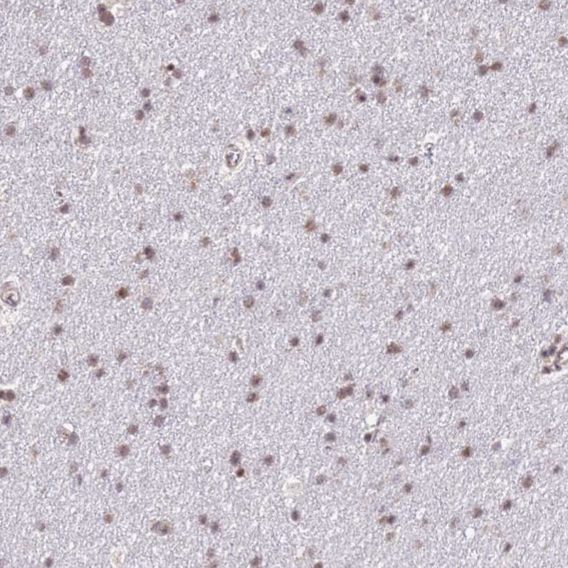 Anti-PRPF6 Antibody
