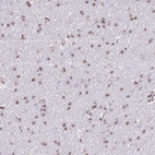Anti-PRPF6 Antibody