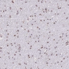 Anti-PRPF6 Antibody