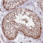 Immunohistochemical staining of human testis shows strong nuclear positivity in cells in seminiferous ducts.