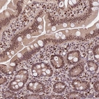 Immunohistochemical staining of human small intestine shows strong nuclear positivity in glandular cells.