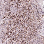 Anti-RNF39 Antibody