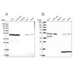 Western blot analysis using Anti-ST13 antibody HPA047116 (A) shows similar pattern to independent antibody HPA046412 (B).