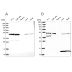 Western blot analysis using Anti-ST13 antibody HPA047116 (A) shows similar pattern to independent antibody HPA046412 (B).