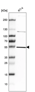 Western blot analysis in human cell line RT-4.