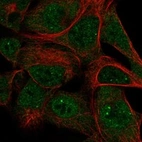 Anti-SKIV2L Antibody