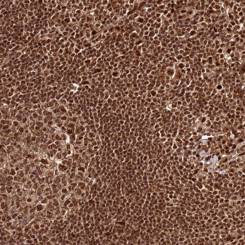 Anti-XRN2 Antibody