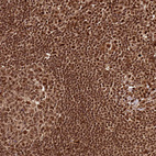 Anti-XRN2 Antibody