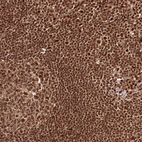 Anti-XRN2 Antibody