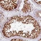 Immunohistochemical staining of human Testis shows strong nuclear positivity in cells in seminiferous ducts and Leydig cells.