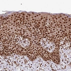 Immunohistochemical staining of human Skin shows strong nuclear positivity in squamous epithelial cells.