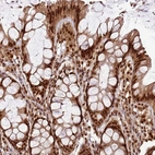 Immunohistochemical staining of human Colon shows strong nuclear positivity in glandular cells.
