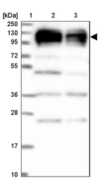 Lane 1: Marker [kDa] 250, 130, 95, 72, 55, 36, 28, 17, 10_br/_Lane 2: Human cell line RT-4_br/_Lane 3: Human cell line U-251MG sp