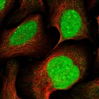 Immunofluorescent staining of human cell line U-2 OS shows localization to nucleus & nucleoli.