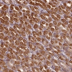 Anti-CCDC159 Antibody