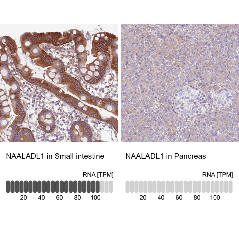 Anti-NAALADL1 Antibody