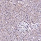 Immunohistochemical staining of human pancreas shows low expression as expected.