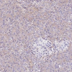 Immunohistochemical staining of human pancreas shows low expression as expected.
