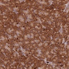 Anti-RPS28 Antibody