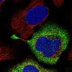 Immunofluorescent staining of human cell line U-2 OS shows localization to cytosol.