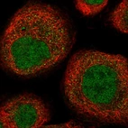Immunofluorescent staining of human cell line A-431 shows localization to nucleoplasm.