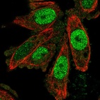 Immunofluorescent staining of human cell line PC-3 shows localization to nucleoplasm & cytosol.