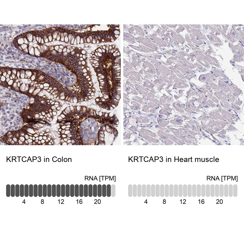 Anti-KRTCAP3 Antibody