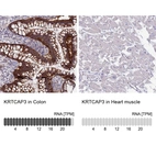 Anti-KRTCAP3 Antibody