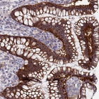 Immunohistochemical staining of human colon shows high expression.
