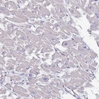 Immunohistochemical staining of human heart muscle shows low expression as expected.