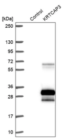 Western blot analysis in control (vector only transfected HEK293T lysate) and KRTCAP3 over-expression lysate (Co-expressed with a C-terminal myc-DDK tag (~3.1 kDa) in mammalian HEK293T cells, LY406322).