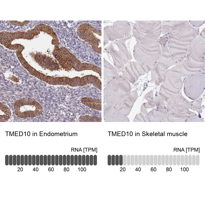 Anti-TMED10 Antibody