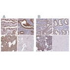 Immunohistochemical staining of human duodenum, endometrium, salivary gland and skeletal muscle using Anti-TMED10 antibody HPA047139 (A) shows similar protein distribution across tissues to independent antibody HPA050539 (B).