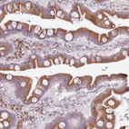 Immunohistochemical staining of human duodenum shows strong granular cytoplasmic positivity in glandular cells.