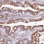 Immunohistochemical staining of human duodenum shows strong granular cytoplasmic positivity in glandular cells.
