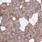 Immunohistochemical staining of human salivary gland shows strong granular cytoplasmic positivity in glandular cells.