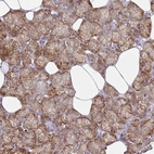 Immunohistochemical staining of human salivary gland shows strong granular cytoplasmic positivity in glandular cells.