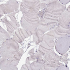 Immunohistochemical staining of human skeletal muscle shows no positivity in myocytes as expected.