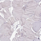 Immunohistochemical staining of human skeletal muscle shows no positivity in myocytes as expected.
