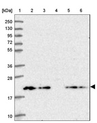 Lane 1: Marker [kDa] 250, 130, 95, 72, 55, 36, 28, 17, 10_br/_Lane 2: Human cell line RT-4_br/_Lane 3: Human cell line U-251MG sp_br/_Lane 4: Human plasma (IgG/HSA depleted)_br/_Lane 5: Human liver tissue_br/_Lane 6: Human tonsil tissue