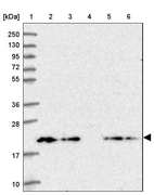 Lane 1: Marker [kDa] 250, 130, 95, 72, 55, 36, 28, 17, 10_br/_Lane 2: Human cell line RT-4_br/_Lane 3: Human cell line U-251MG sp_br/_Lane 4: Human plasma (IgG/HSA depleted)_br/_Lane 5: Human liver tissue_br/_Lane 6: Human tonsil tissue