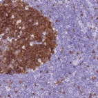 Anti-SPC25 Antibody