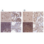 Anti-TOR1AIP1 Antibody