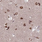 Immunohistochemical staining of human cerebral cortex using Anti-TOR1AIP1 antibody HPA047151.